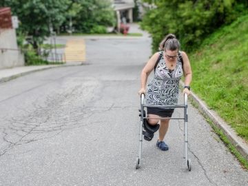 A woman with a leg cast and walker walks up a road.